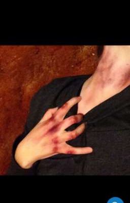 жизнь или смерть?