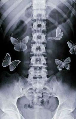 Любовный треугольник 