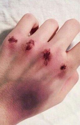 История одной несчастной