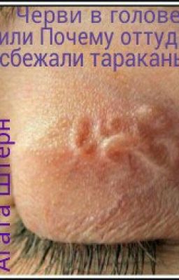 Черви в голове, или Почему оттуда сбежали тараканы